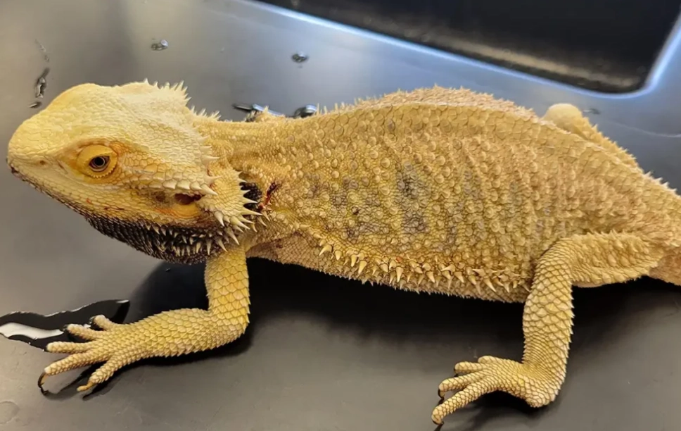 metabolic bone disease MBD